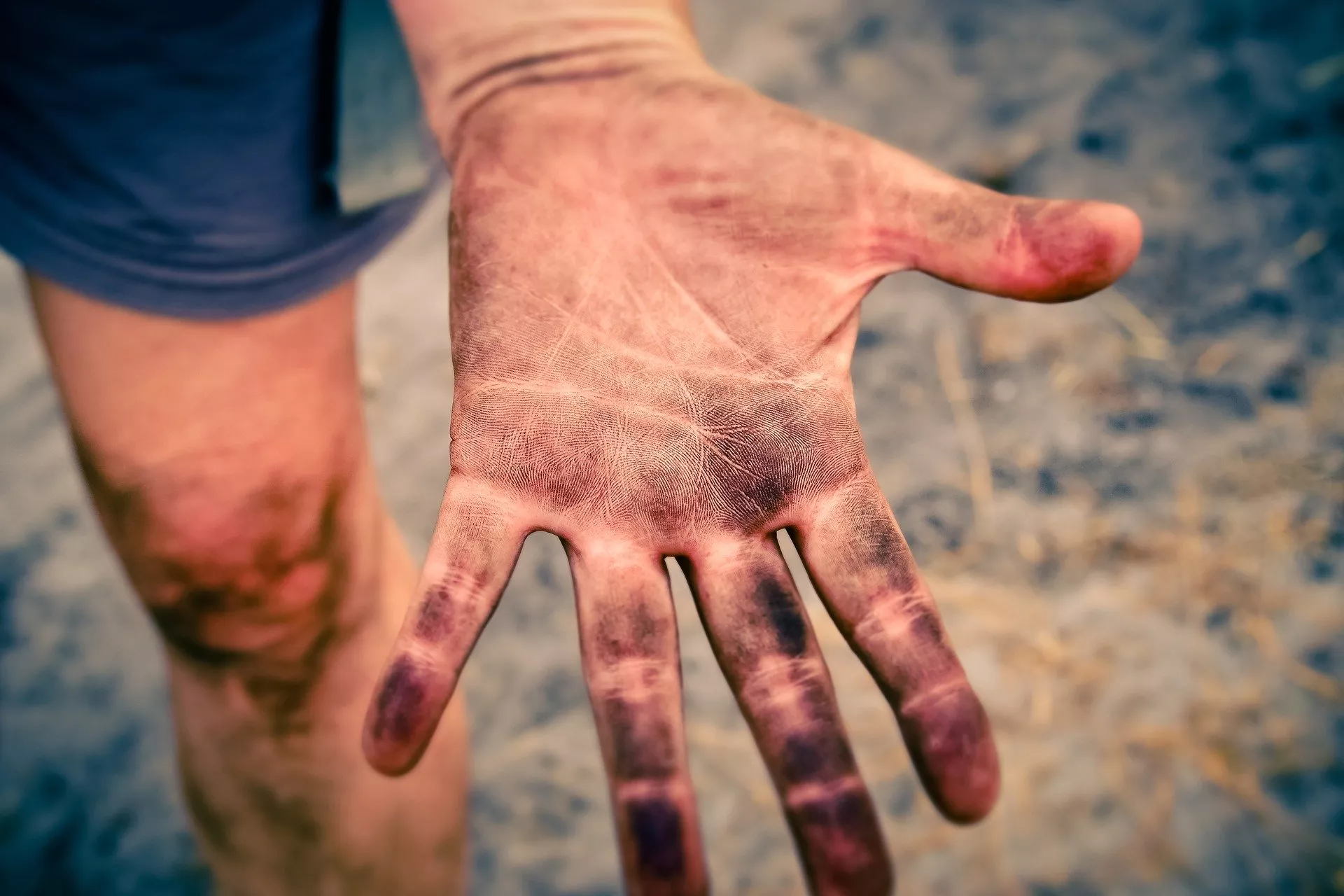 This Riddle is about being dirty. This is the picture of a dirty hand!